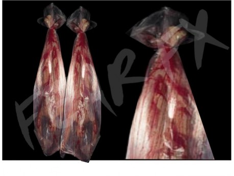 Cadaver Bags