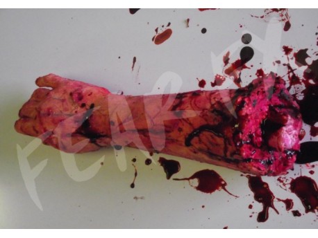 Zombie Arm