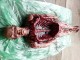 Autopsy Body