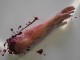 Severed Arm Left Handed