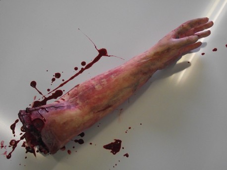 Severed Arm Left Handed