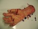 Severed Forearm R/H